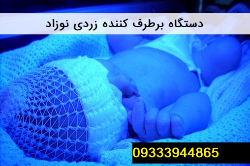 زردی نوزاد