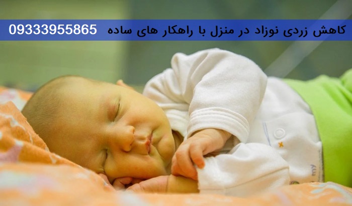 زردی نوزاد