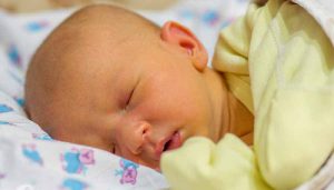 علت بروز زردی در نوزادان و راه های درمان آن