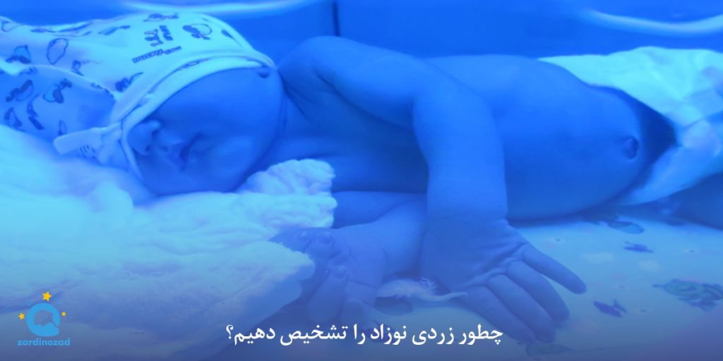 تشخیص زردی نوزاد