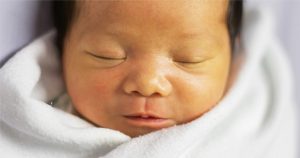 درمان زردی نوزاد بدون دستگاه فتوتراپی